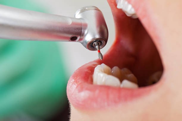 Best Urgent Dental Care for Toothache in Norlina, NC